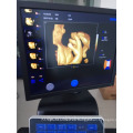 3D 4D USG Full digital 4D Ultrasound Price Trolley 4D Ultrasound Machine